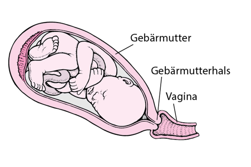 Gebärmutterhals 1 5 Cm Wann Geburt