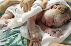 vernix-caseosa-kaeseschmiere